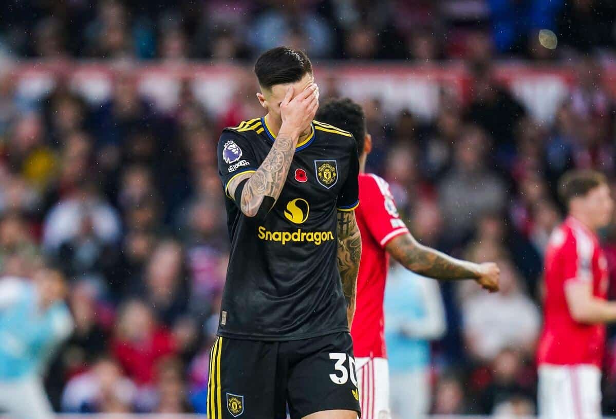 Man Utd striker Cesko’s injury is not that serious