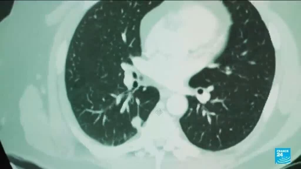 Researchers use AI to detect cancer