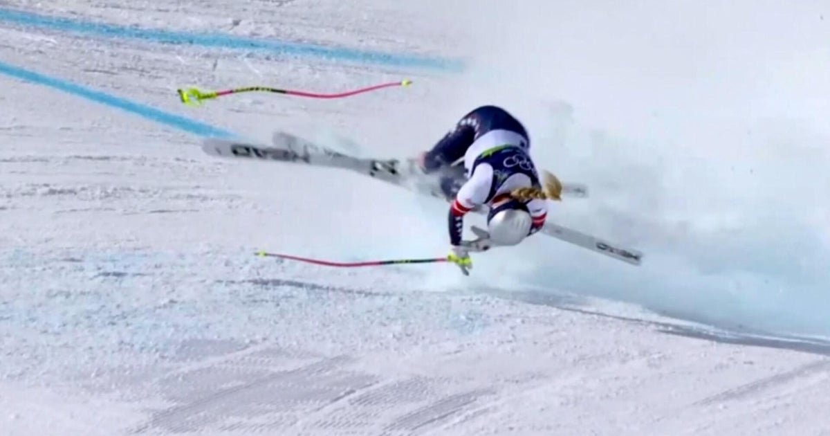 Lindsey Vonn breaks her leg in an accident at the Olympics, Trump calls the skier a loser for comments about American politics